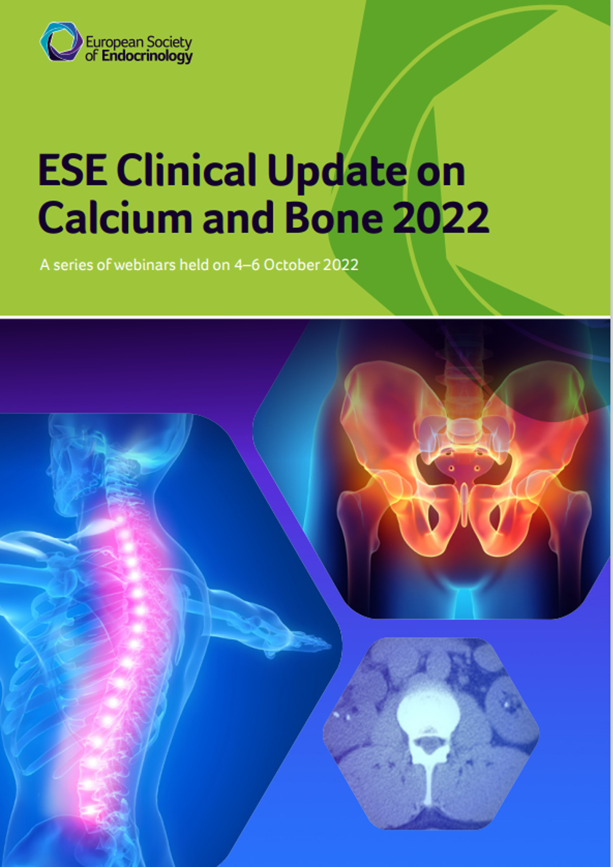 ESE Clinical Update on Calcium and Bone Online, 4 - 6 October 2022 Meeting Report